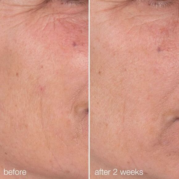 BNIB Dermalogica Dynamic Skin Retinol Serum Antiaging Retexturizing Mini .34 oz - Picture 7 of 12